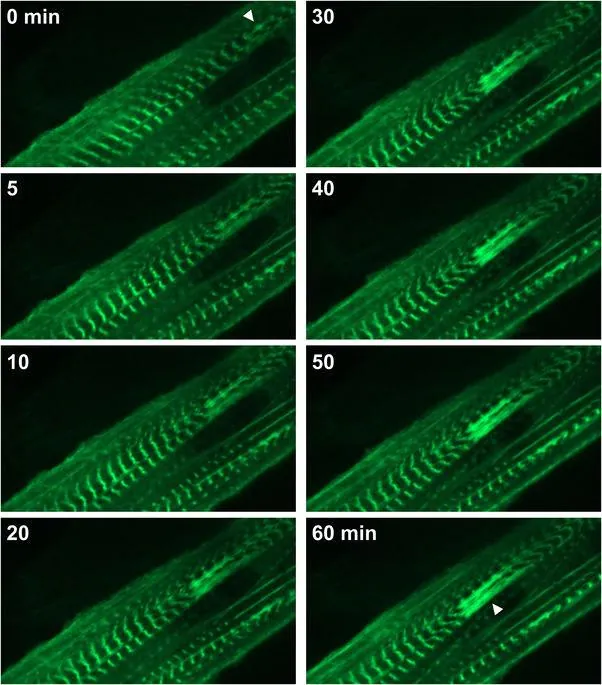 lesion-sarcomere-microscope